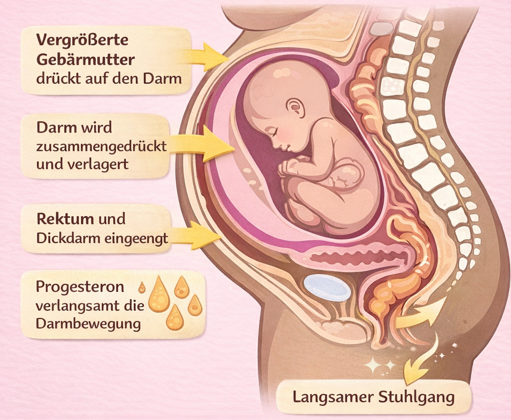 Verstopfung in der Schwangerschaft
